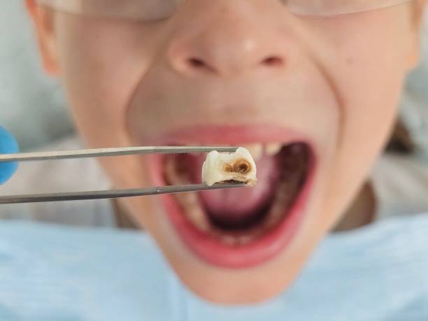 Best Emergency Denture Repair in Algonquin, MD